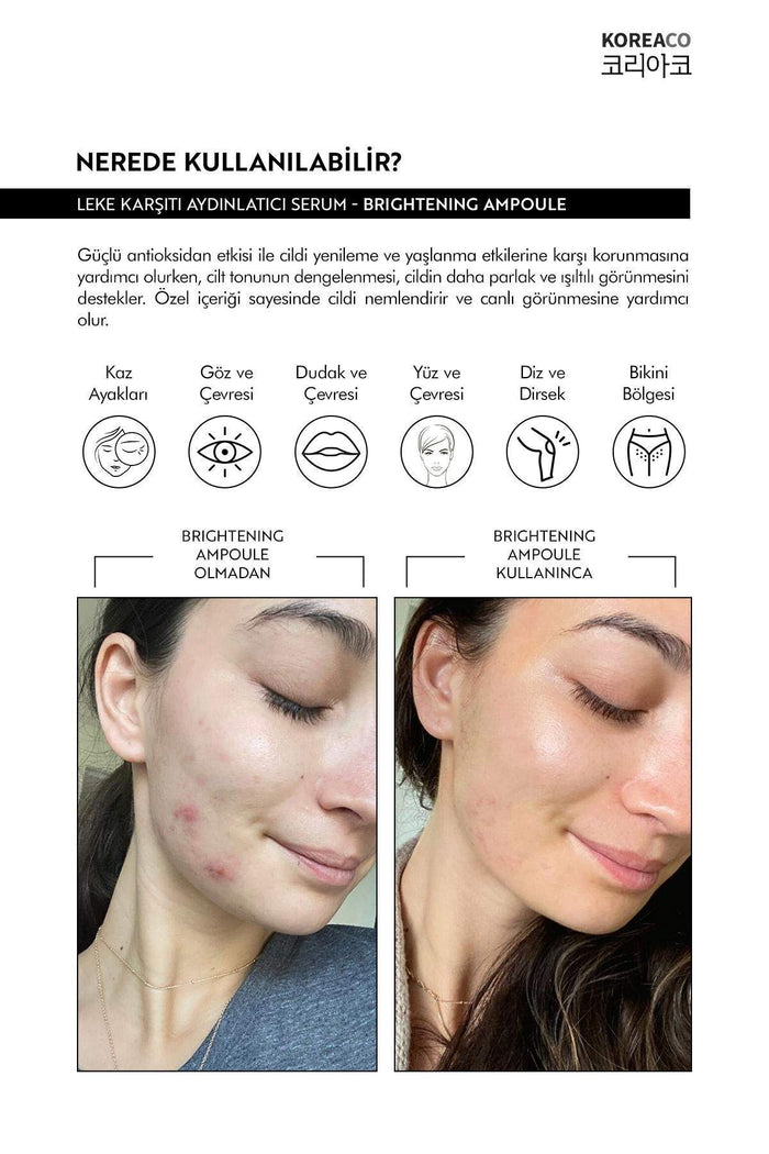 KOREACO Anti-Dark Spot & Tone Equalizing Brightening Ampoule is designed to help visibly reduce the appearance of dark spots while promoting a more even, radiant-looking complexion.