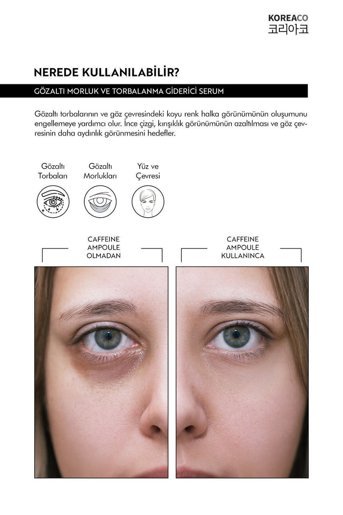 KOREACO Caffeine Under Eye Dark Circle and Puffiness Ampoule Serum is designed to visibly reduce the look of dark circles, under-eye bags, and tired-looking skin.